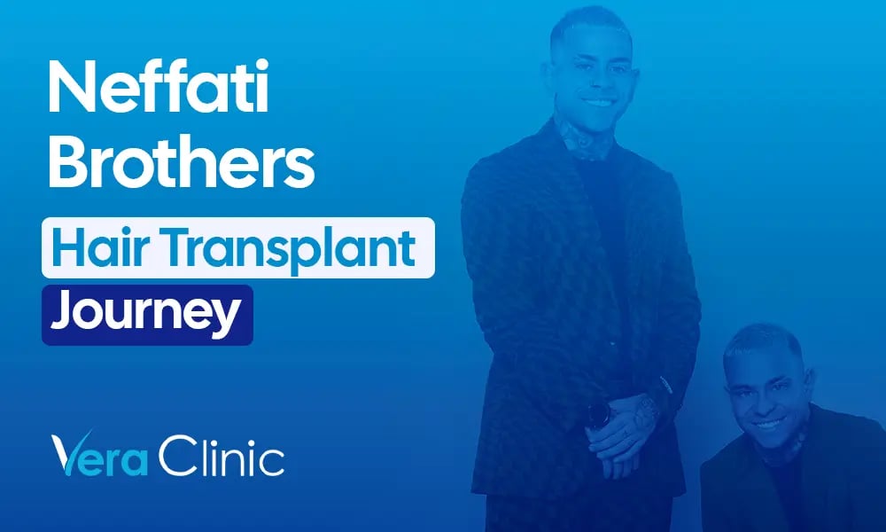 Neffati Brothers celebrity hair transplant before and after