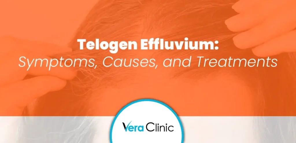 Telogen Effluvium