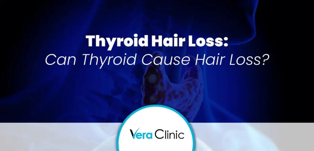 Thyroid Hair Loss