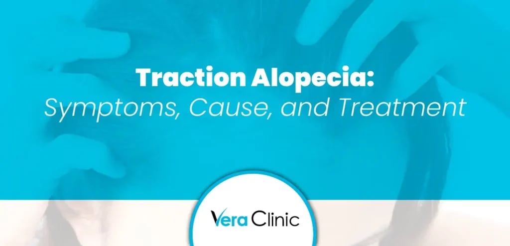 Traction Alopecia