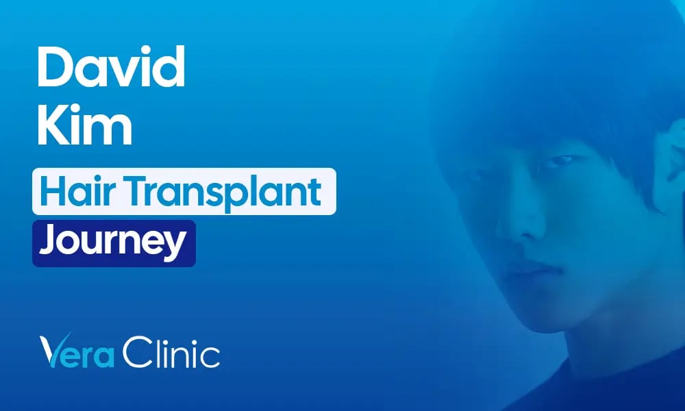 David Kim celebrity hair transplant before and after