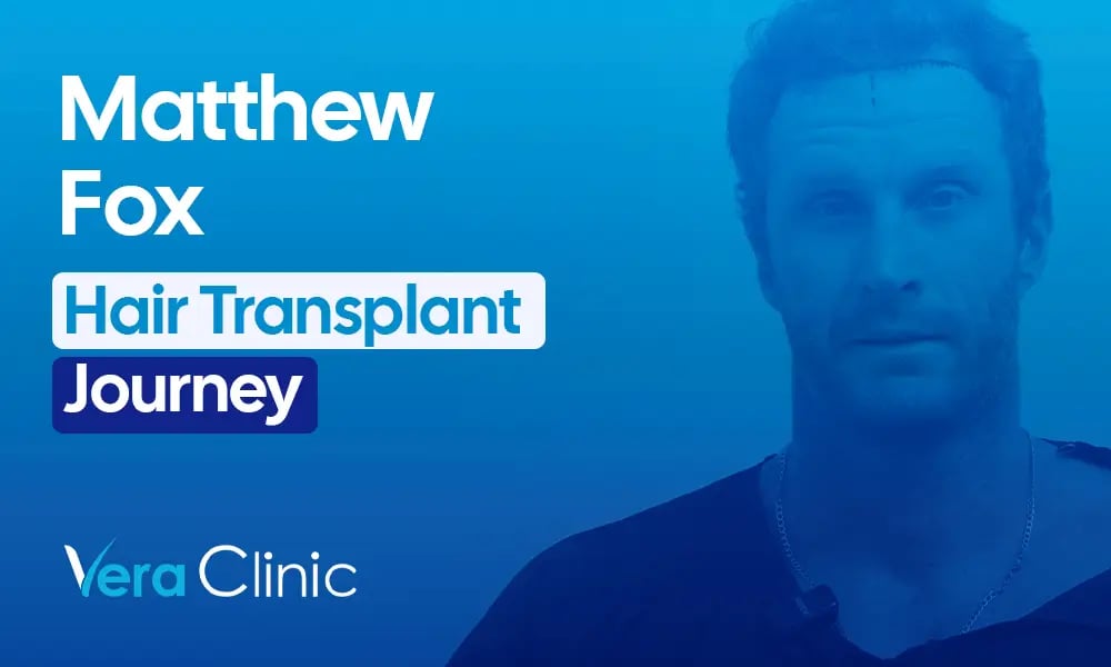 Matthew Fox celebrity hair transplant before and after