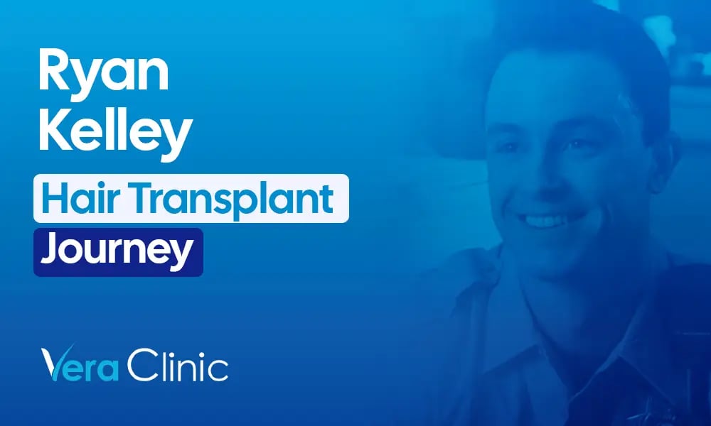 Ryan Kelley celebrity hair transplant before and after