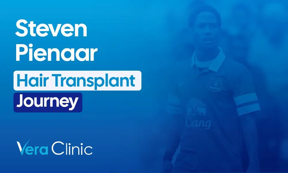 Steven Pienaar celebrity hair transplant before and after