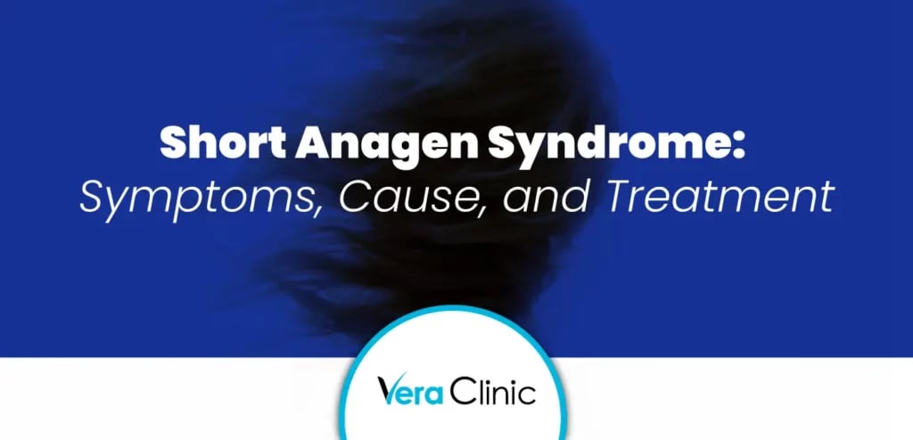 Short Anagen Syndrome