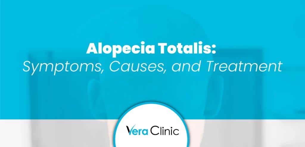 Alopecia Totalis