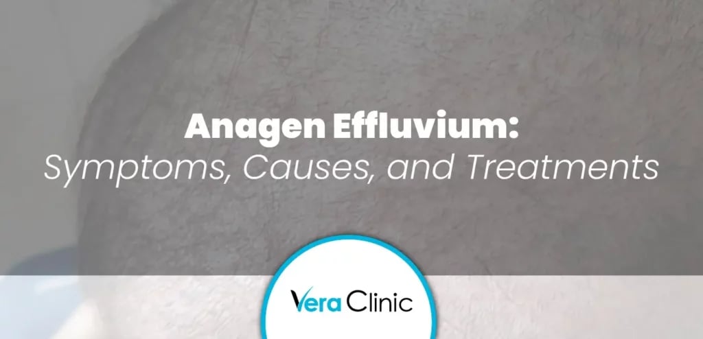 Anagen Effluvium