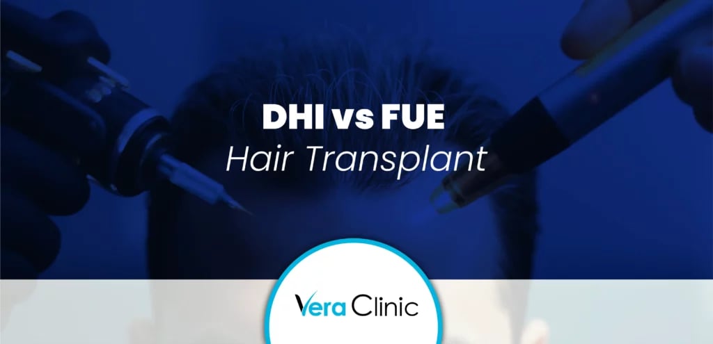 DHI vs FUE Hair Transplant