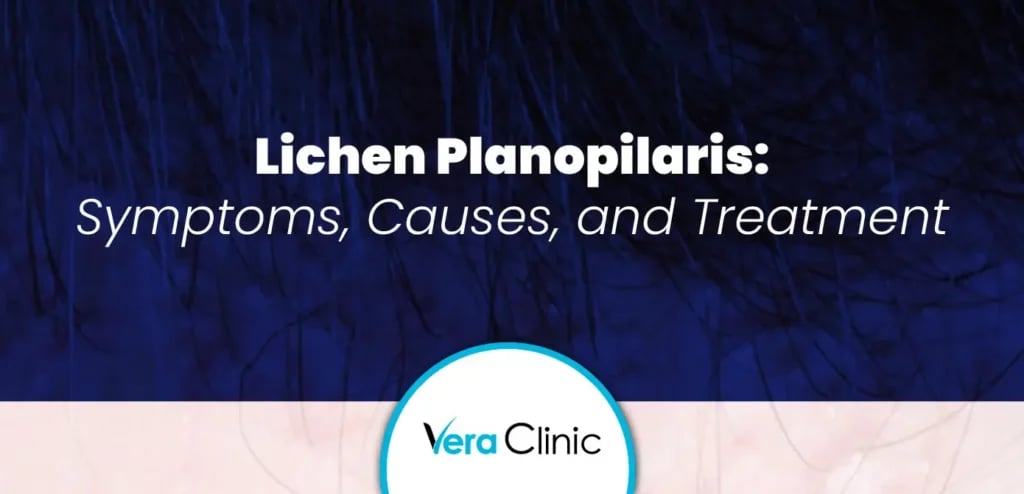 Lichen Planopilaris