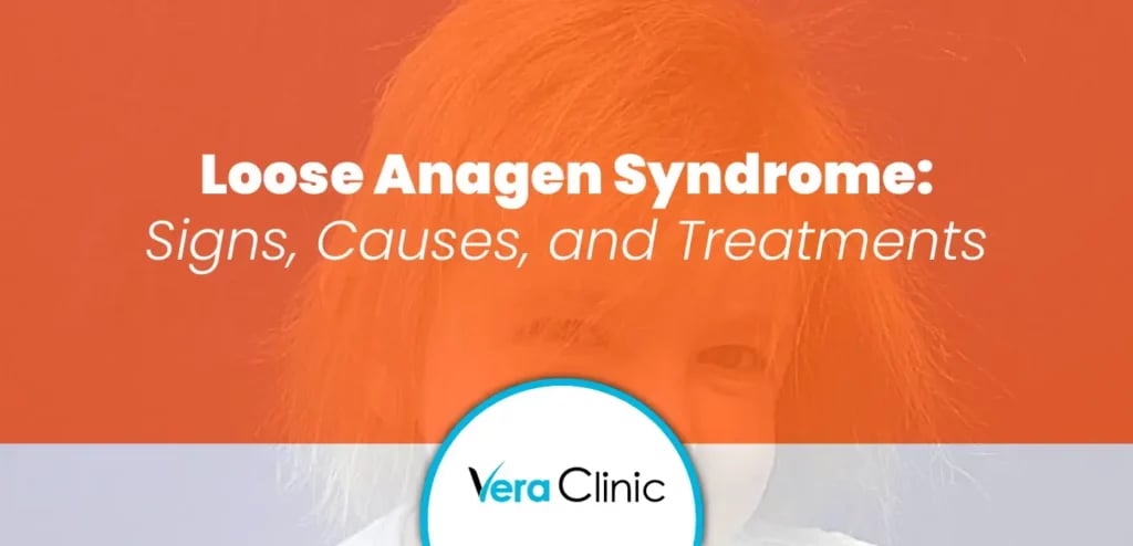 Loose Anagen Syndrome