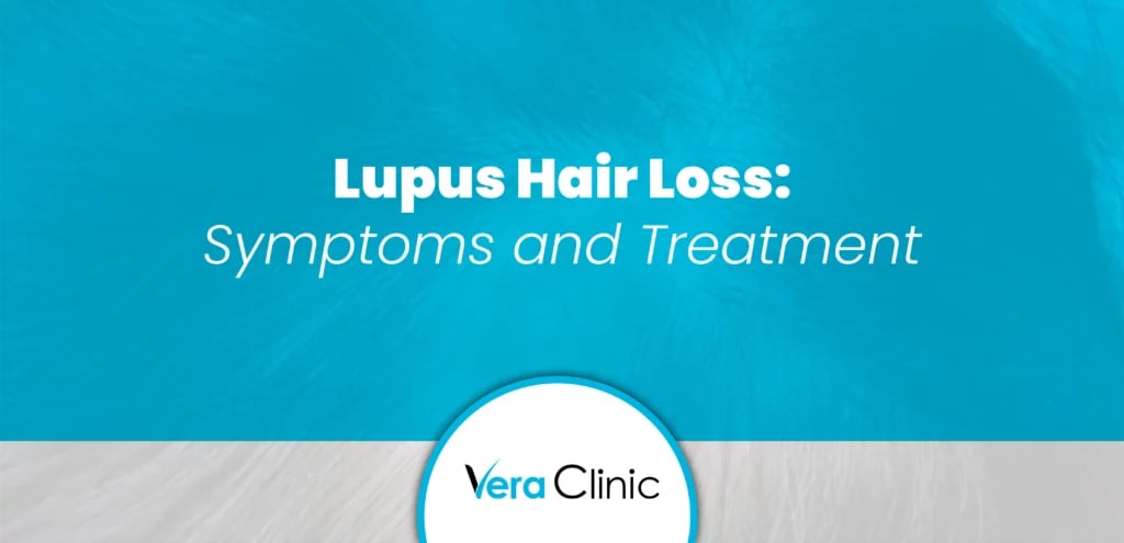 Lupus Hair Loss