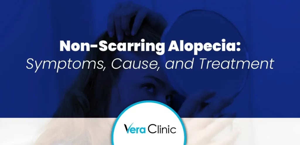 Non-Scarring Alopecia