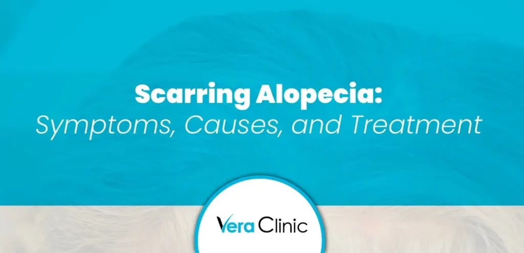 Scarring Alopecia