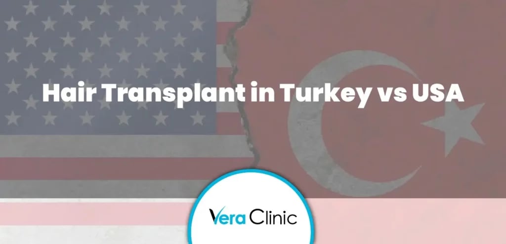 Hair Transplant in Turkey vs USA