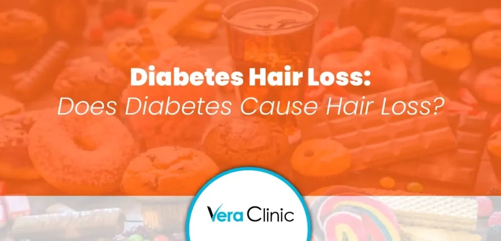 Diabetes Hair Loss