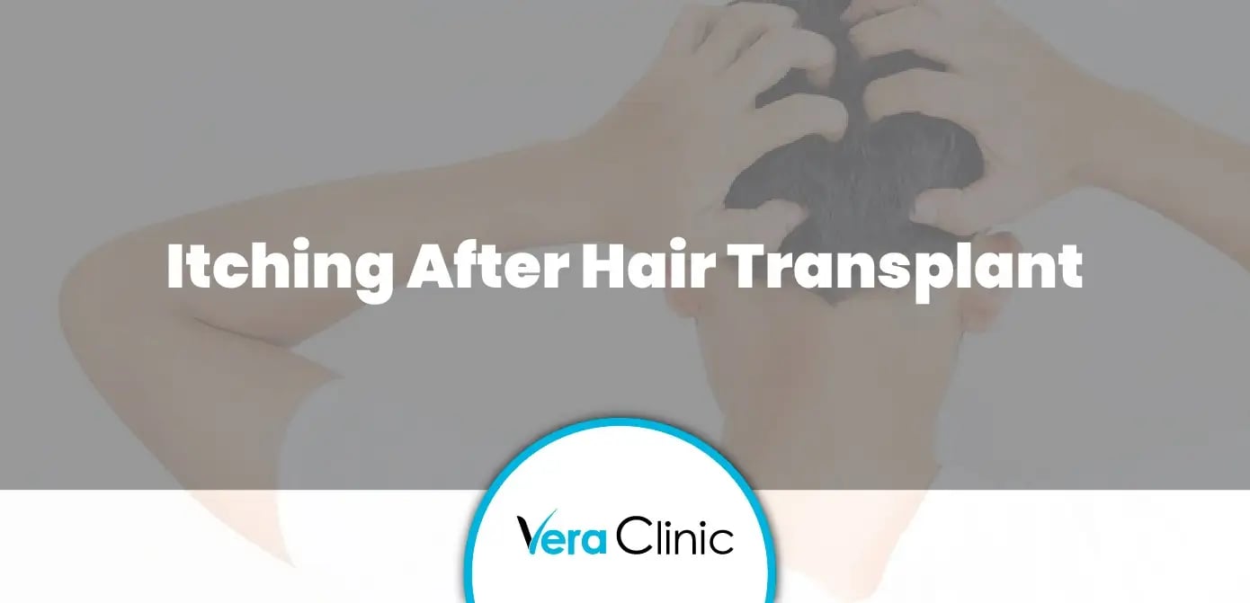 Itching After Hair Transplant Vera Clinic