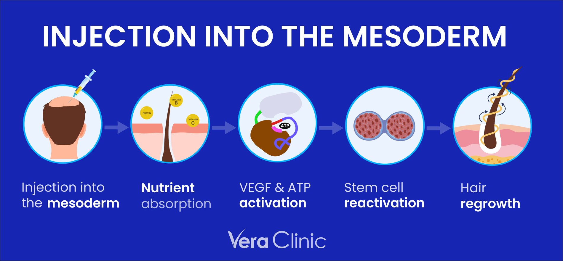 Mesoderm