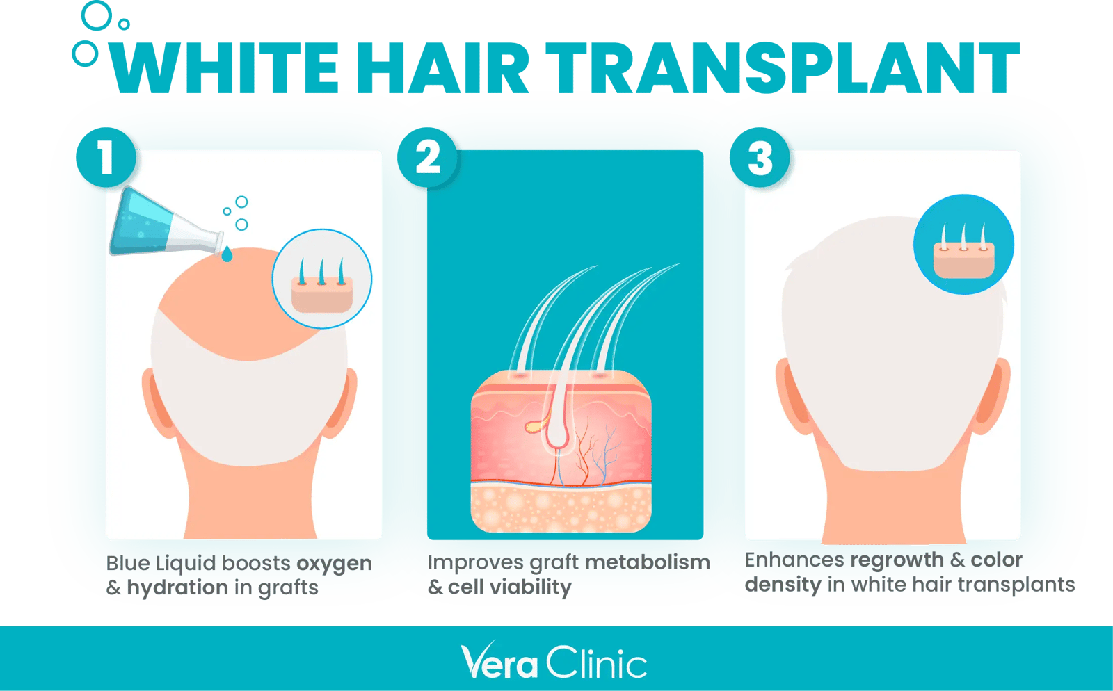 white hair transprent methylene blue use in white hair transplant surgery