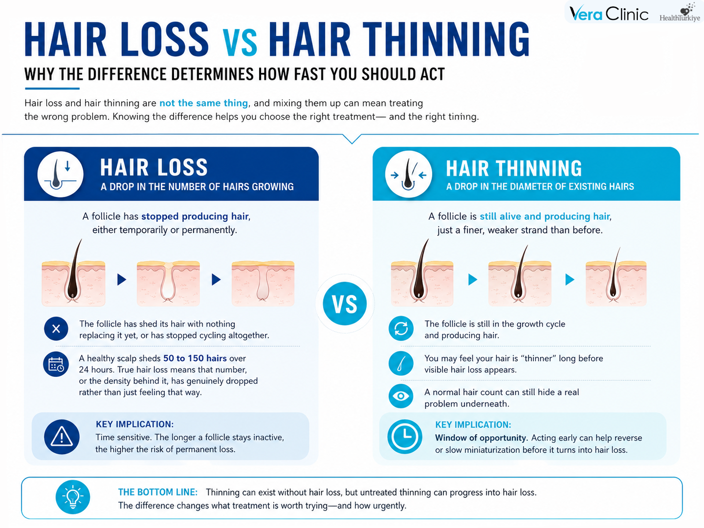 Hair Loss vs Hair Thinning