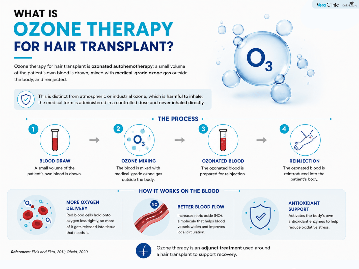 Ozone Therapy for Hair Transplant