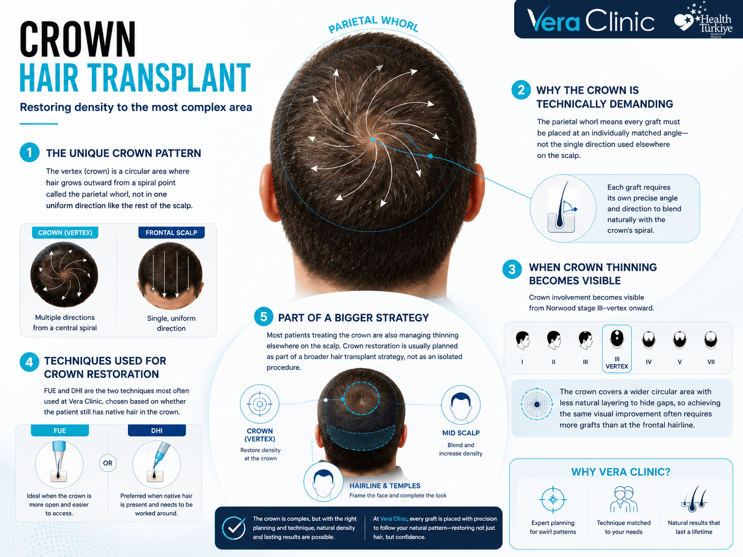 Crown Hair Transplant
