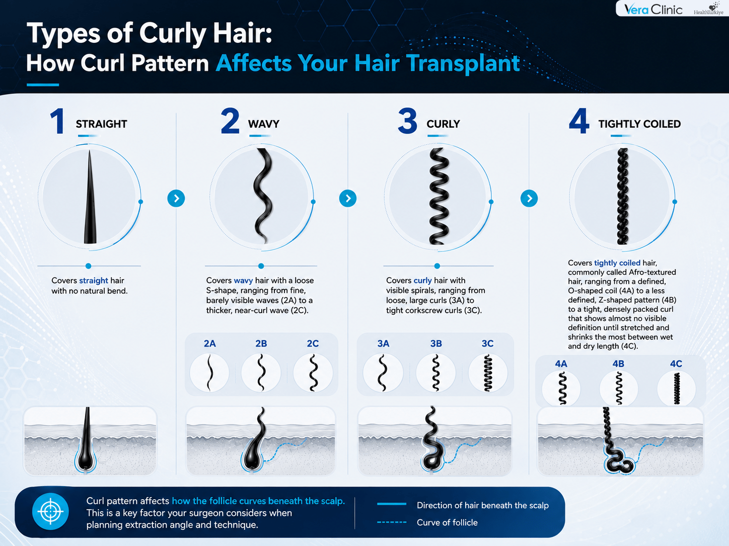 Types of Curly Hair