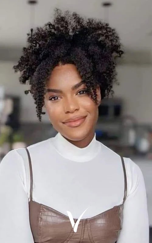 Dieselbe Patientin 12 Monate nach einer Afro-Haartransplantation mit 2.100 Transplantaten in der Vera Clinic