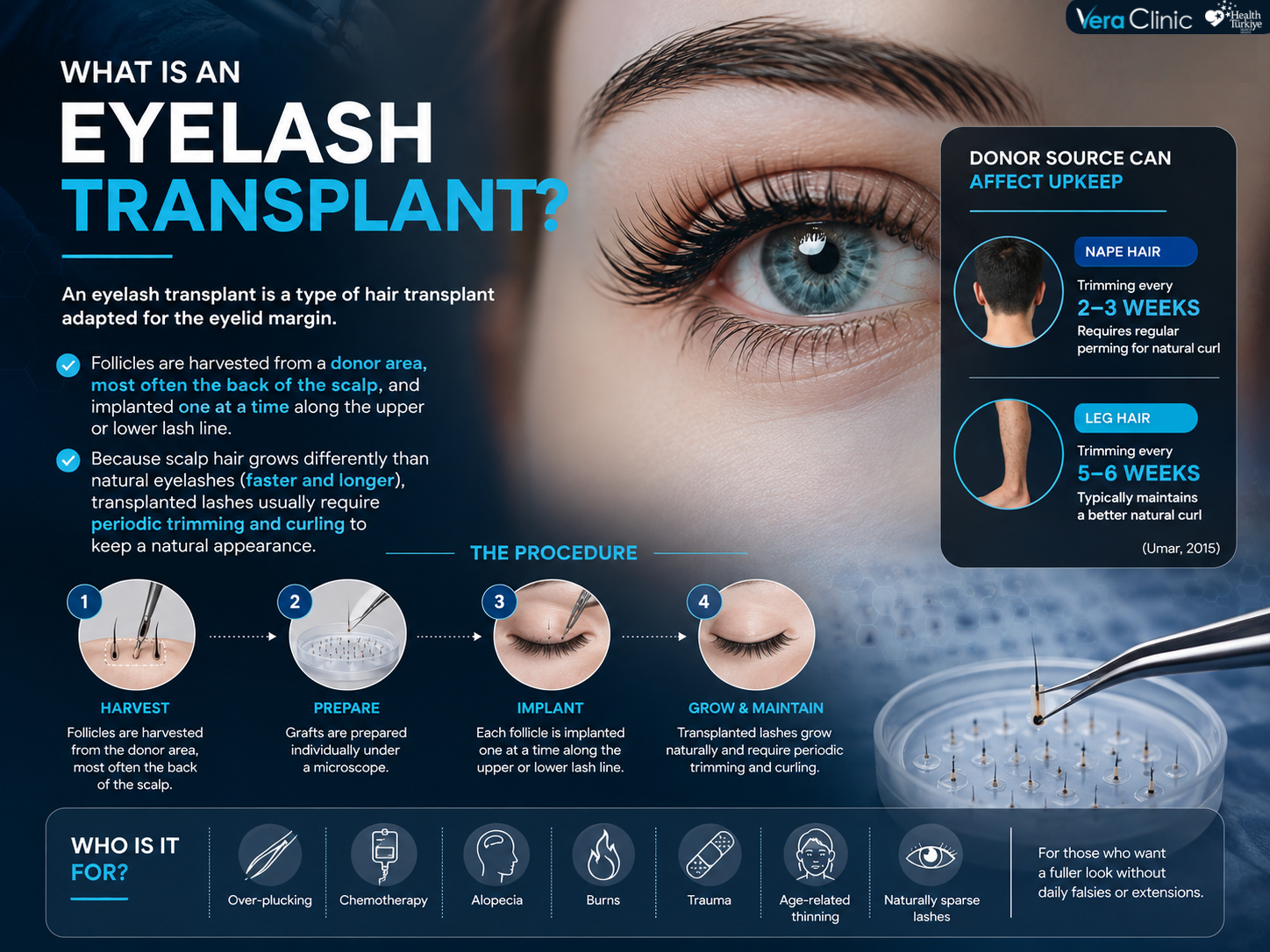 eyelash transplant