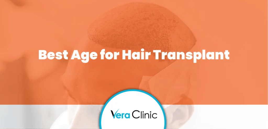 best age for hair transplant