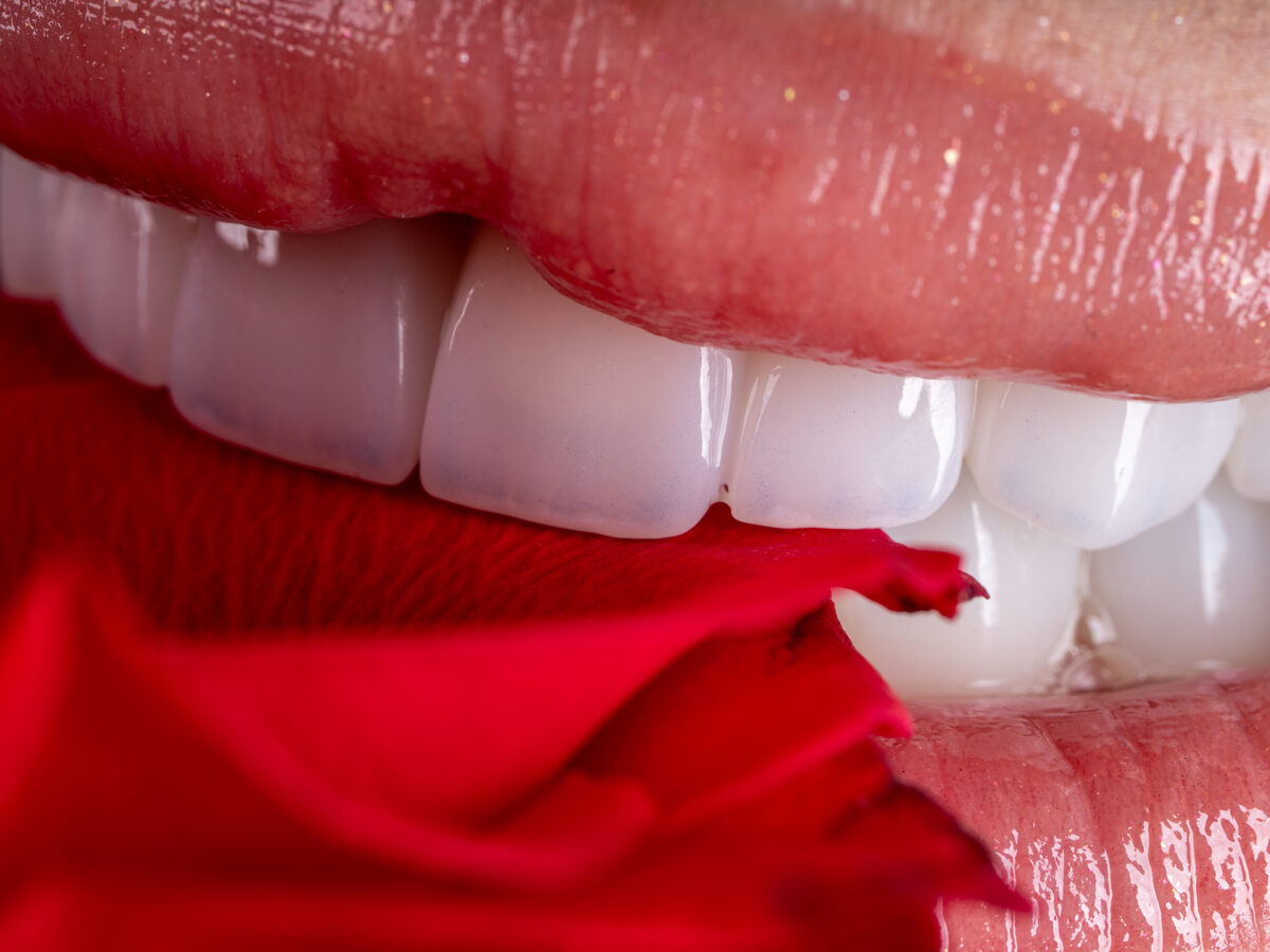 Close-up of bright, evenly shaped teeth restored with crowns