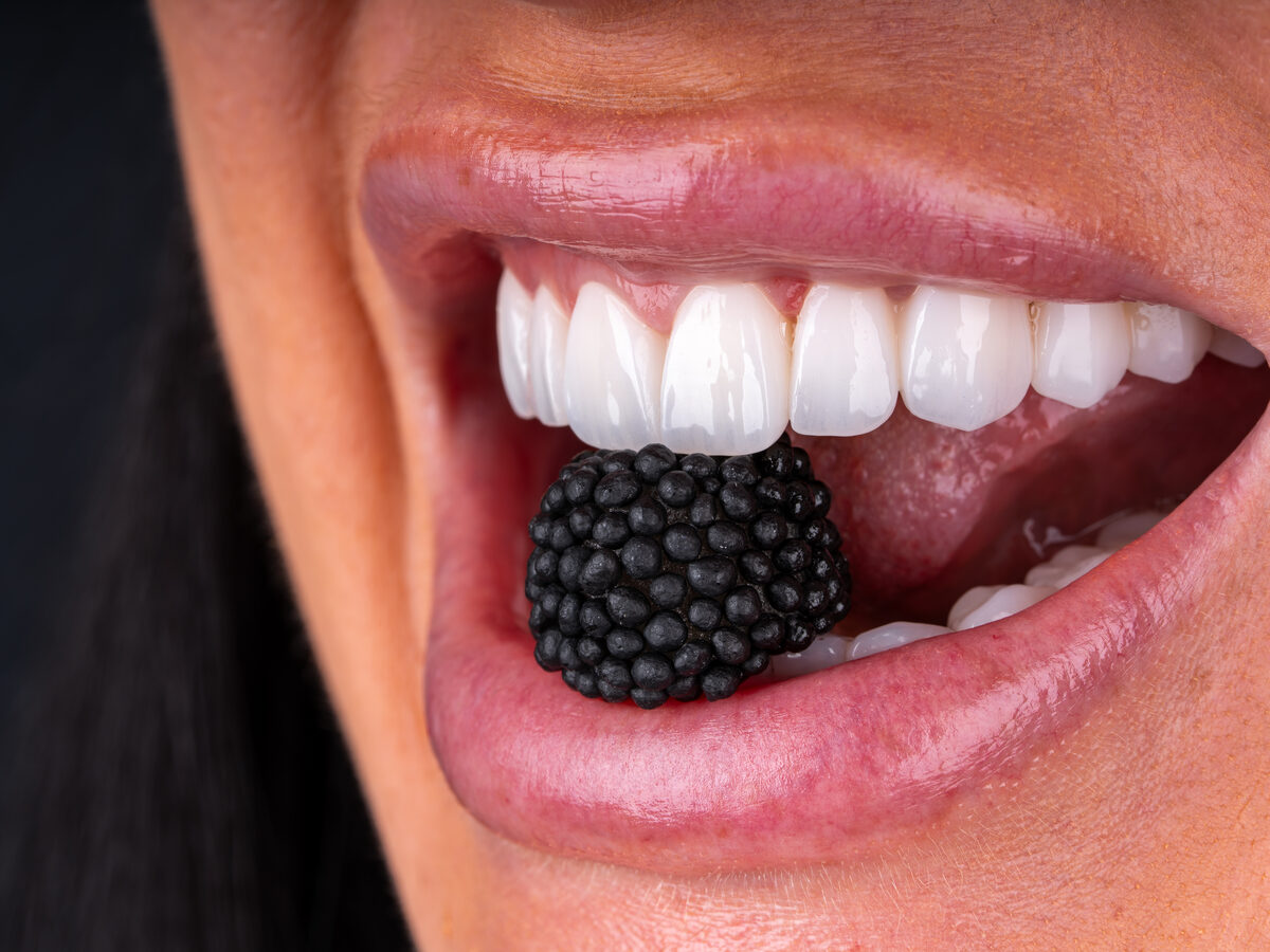 A full upper arch of even, natural-looking teeth