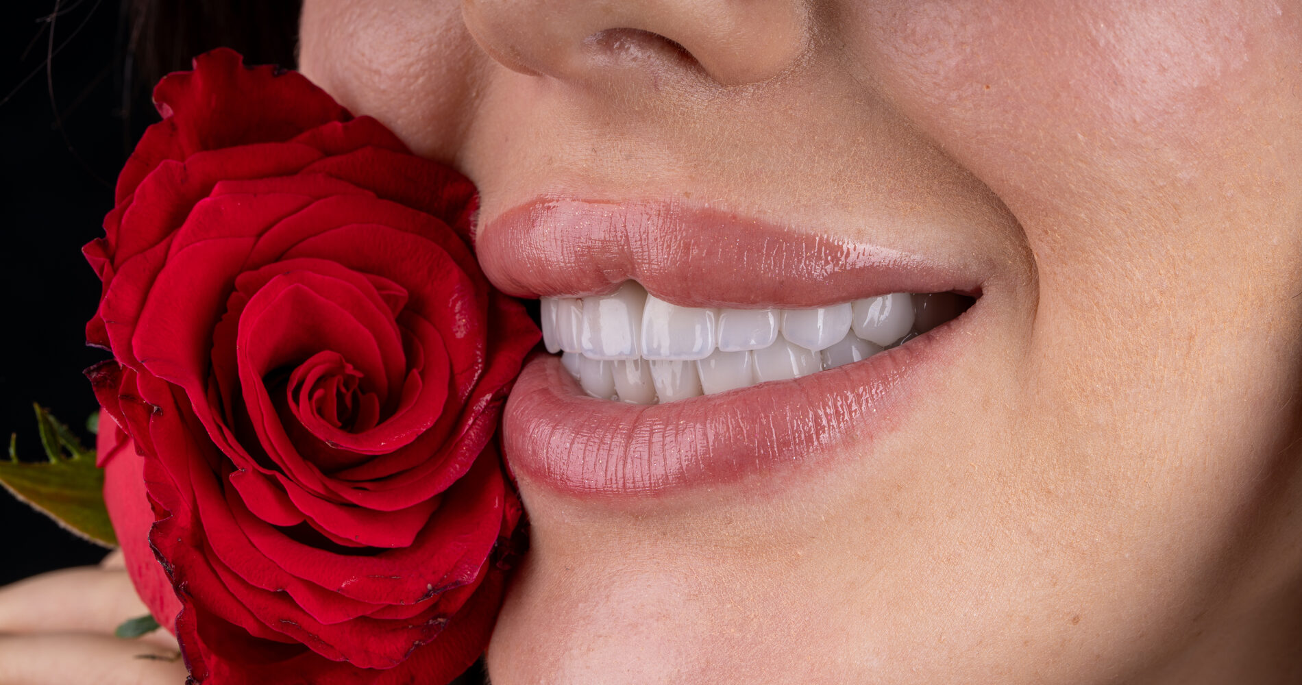 Close-up of a natural, even smile after dental treatment at Vera Clinic